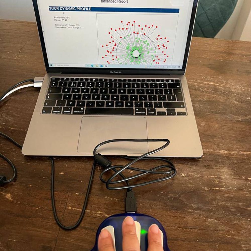 Zyto scan – the flower of life Amsterdam Zyto scan - the flower of life Amsterdam